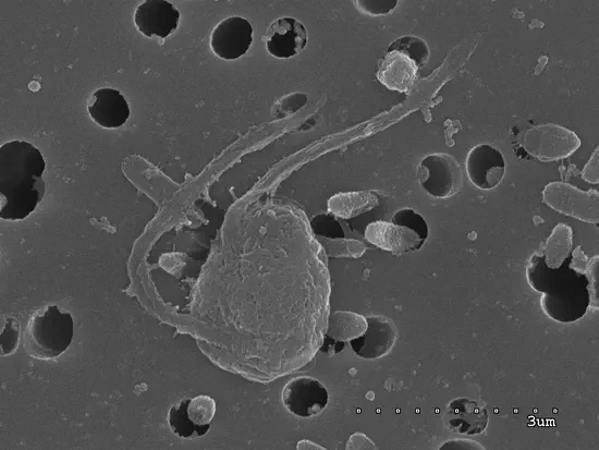 The genome of *Mediocremonas mediterraneus*