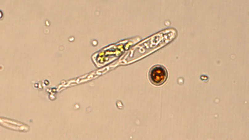 A transcriptomic cell-atlas of reef coral bleaching