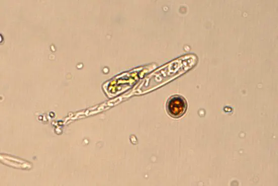 A transcriptomic cell-atlas of reef coral bleaching